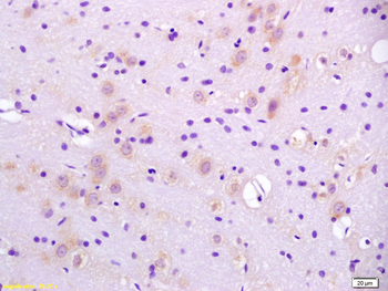 CaIPLA2 Rabbit Polyclonal Antibody
