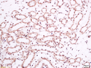 Ubiquitously expressed transcript Rabbit Polyclonal Antibody