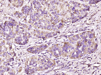 SEMA4A Rabbit Polyclonal Antibody