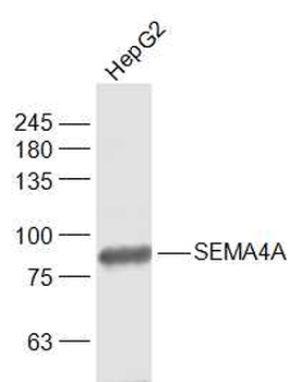 SEMA4A Rabbit Polyclonal Antibody