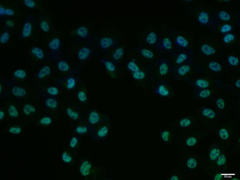 PKM2 Mouse Polyclonal Antibody