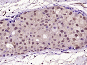 HER2 Mouse Monoclonal Antibody