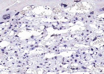 BRCA2 Rabbit Polyclonal Antibody