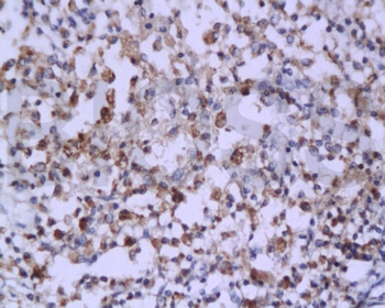 Caspase-6 Rabbit Polyclonal Antibody