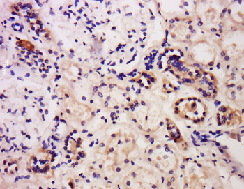 Caspase-6 Rabbit Polyclonal Antibody