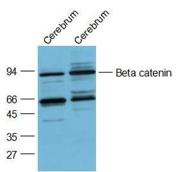 Beta catenin Rabbit Polyclonal Antibody