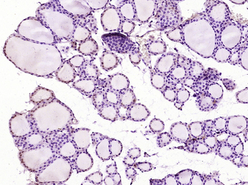 RUNX2 Rabbit Polyclonal Antibody