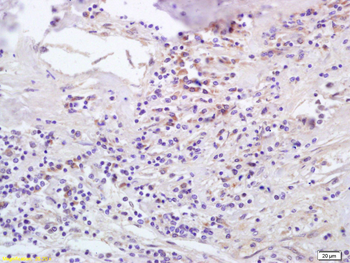 RANTES Rabbit Polyclonal Antibody