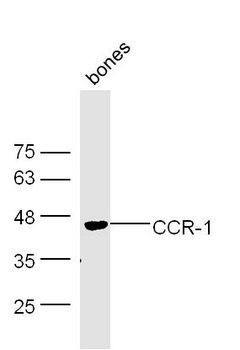 CCR-1/CD191 Rabbit Polyclonal Antibody