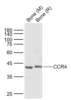 CCR4 Rabbit Polyclonal Antibody