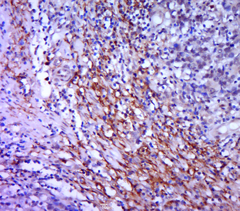 Syndecan-1 Rabbit Polyclonal Antibody