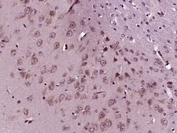 CD147 Rabbit Polyclonal Antibody