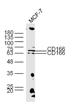 CD166 Rabbit Polyclonal Antibody