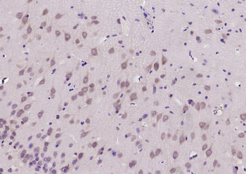 B3GAT1 Rabbit Polyclonal Antibody