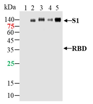 SARS-CoV-2 (2019-nCoV) Spike S1 Mouse Monoclonal Antibody