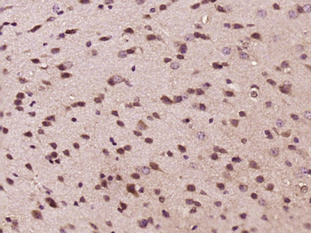 CDK5 Rabbit Polyclonal Antibody