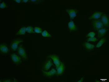 CDK7 Rabbit Polyclonal Antibody