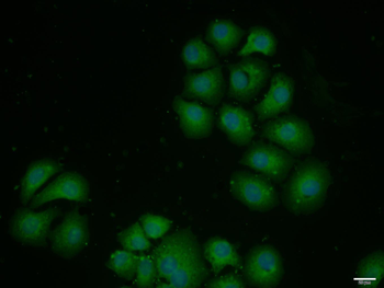 CDK7 Rabbit Polyclonal Antibody
