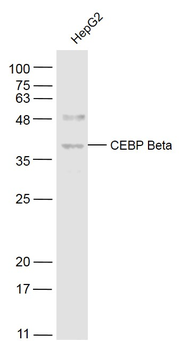 CEBP Beta Rabbit Polyclonal Antibody