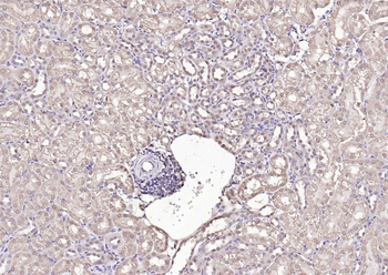 Proteasome 20S alpha 1 Rabbit Polyclonal Antibody