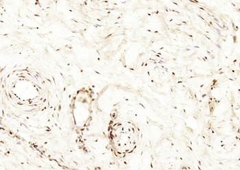 Cytokeratin 4 Rabbit Polyclonal Antibody