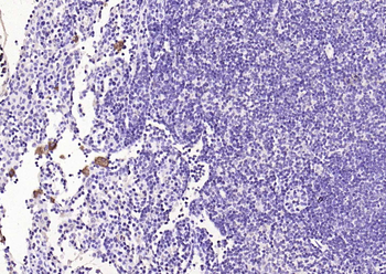 CCR7 Rabbit Polyclonal Antibody