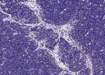 CCR7 Rabbit Polyclonal Antibody