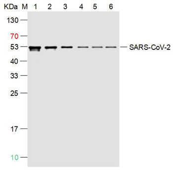SARS-CoV-2 (2019-nCoV) Nucleocapsid, WT & Ormicron Recognized Recombinant Rabbit Monoclonal Antibody