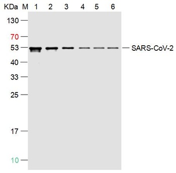 SARS-CoV-2 (2019-nCoV) Nucleocapsid antibody