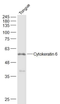 Cytokeratin 6 Rabbit Polyclonal Antibody