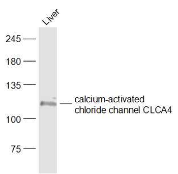 Calcium-activated chloride channel CLCA4 Rabbit Polyclonal Antibody
