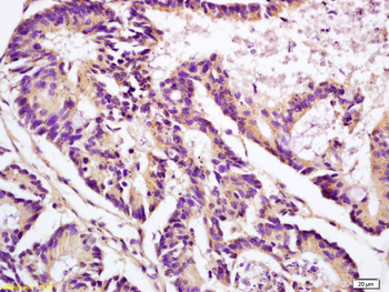 Clusterin Rabbit Polyclonal Antibody