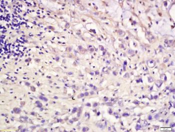 MET Rabbit Polyclonal Antibody