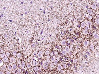 CNR1 Rabbit Polyclonal Antibody