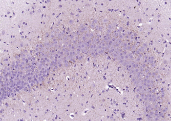 CNR1 Rabbit Polyclonal Antibody