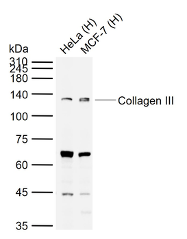 Collagen III Rabbit Polyclonal Antibody