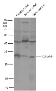CALB2 Rabbit Polyclonal Antibody