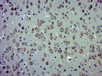 CRMP2 Rabbit Polyclonal Antibody