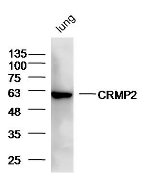 CRMP2 Rabbit Polyclonal Antibody