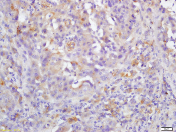 RAF1 Rabbit Polyclonal Antibody