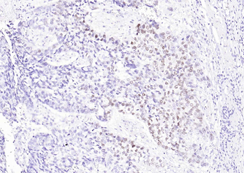 P63 Mouse Monoclonal Antibody