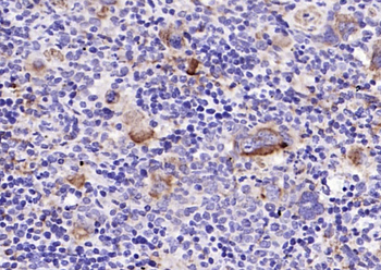 GP1BA Recombinant Rabbit Monoclonal Antibody