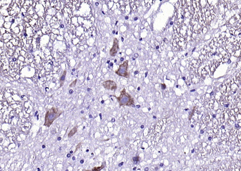 CX3CR1 Rabbit Polyclonal Antibody