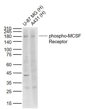MCSF Receptor (Phospho-Tyr546) antibody