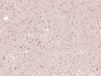 Cyclin D3 Rabbit Polyclonal Antibody