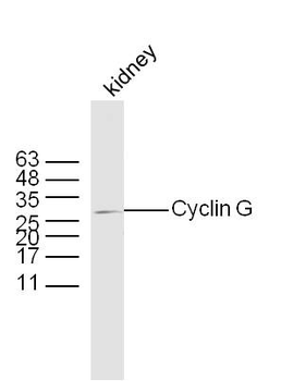 Cyclin G Rabbit Polyclonal Antibody