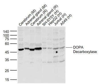 DOPA decarboxylase antibody