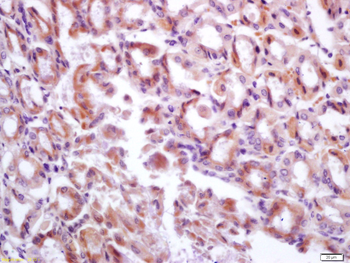 DMBT1 Rabbit Polyclonal Antibody