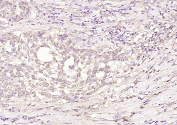 SPRR3 Rabbit Polyclonal Antibody