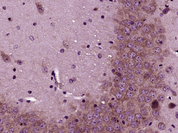 DVL1 Rabbit Polyclonal Antibody